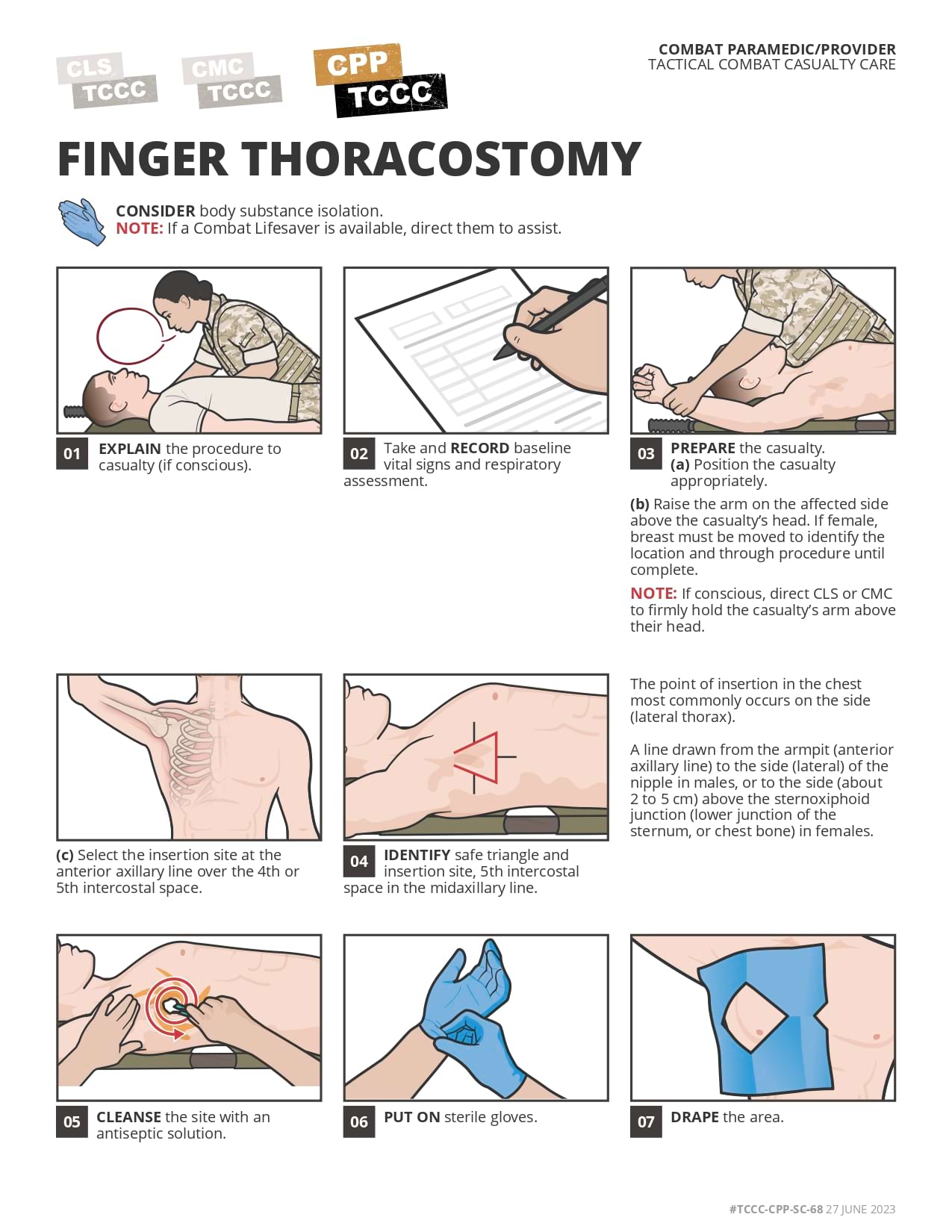 Finger Thoracostomy , cpp, page 1