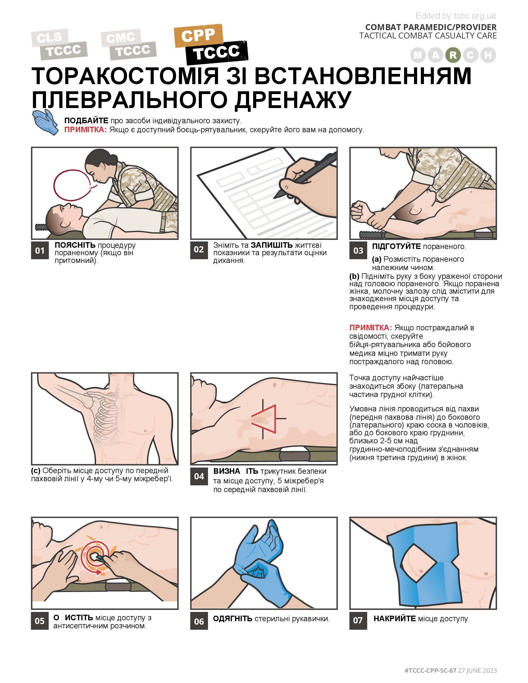 Торакостомія зі встановленням плеврального дренажу, cpp, сторінка 1