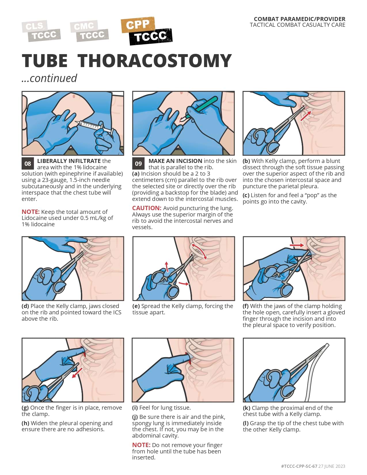 Tube Thoracostomy, cpp, page 2