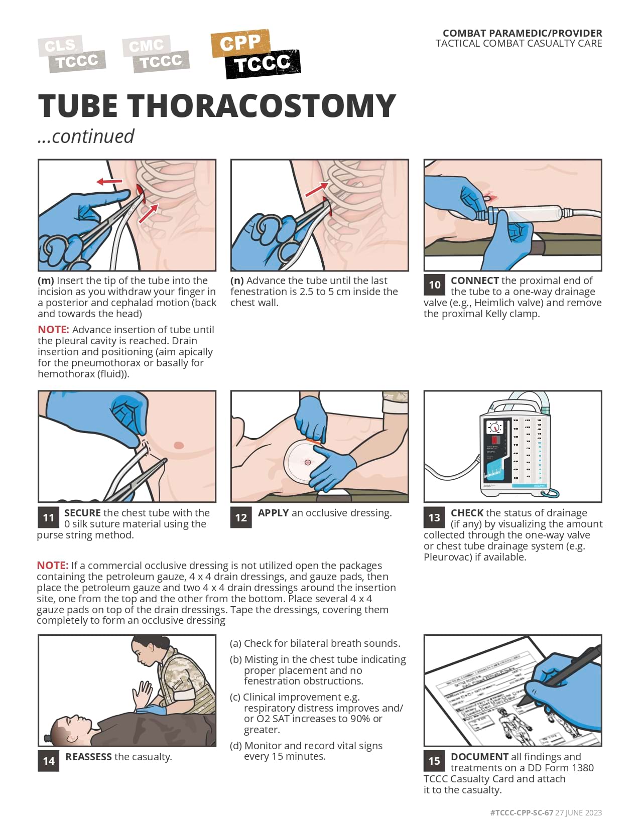 Skill Card 29: Tube Thoracostomy