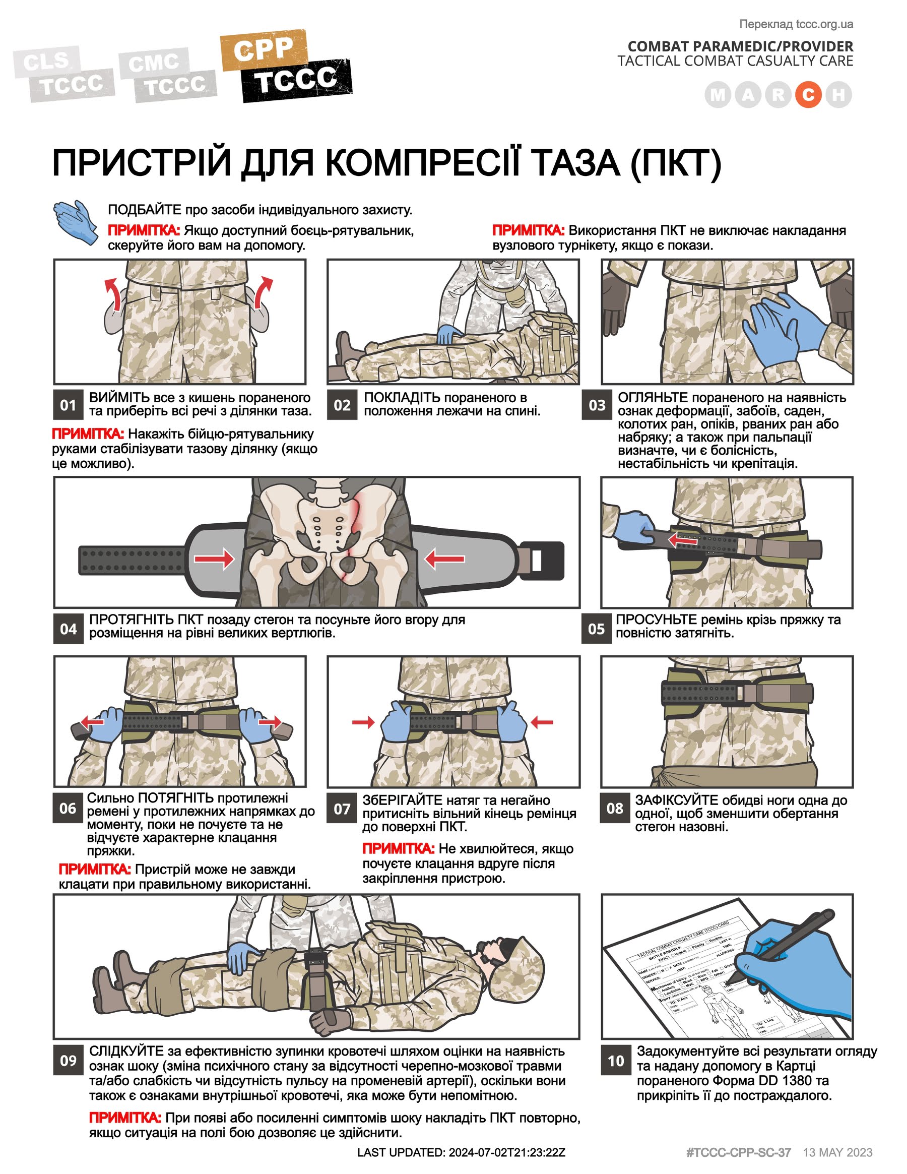 Пристрій для компресії таза (ПКТ), cpp