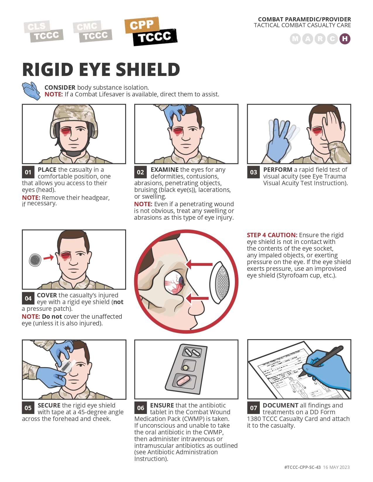 Rigid Eye Shield, cpp