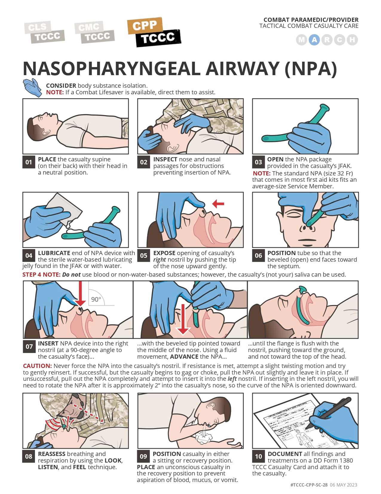 Nasopharyngeal Airway (NPA), cpp