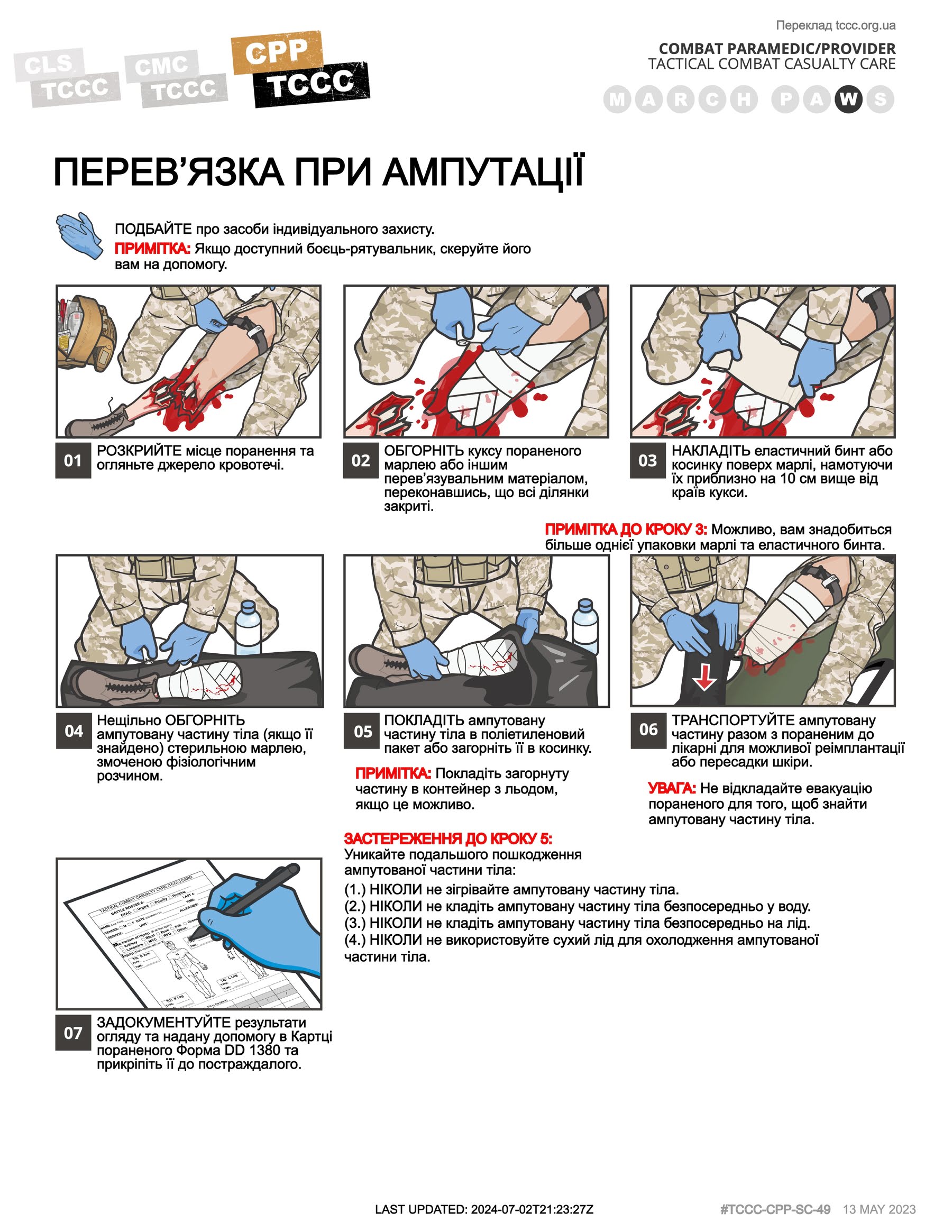 Перев’язка при ампутації, cpp