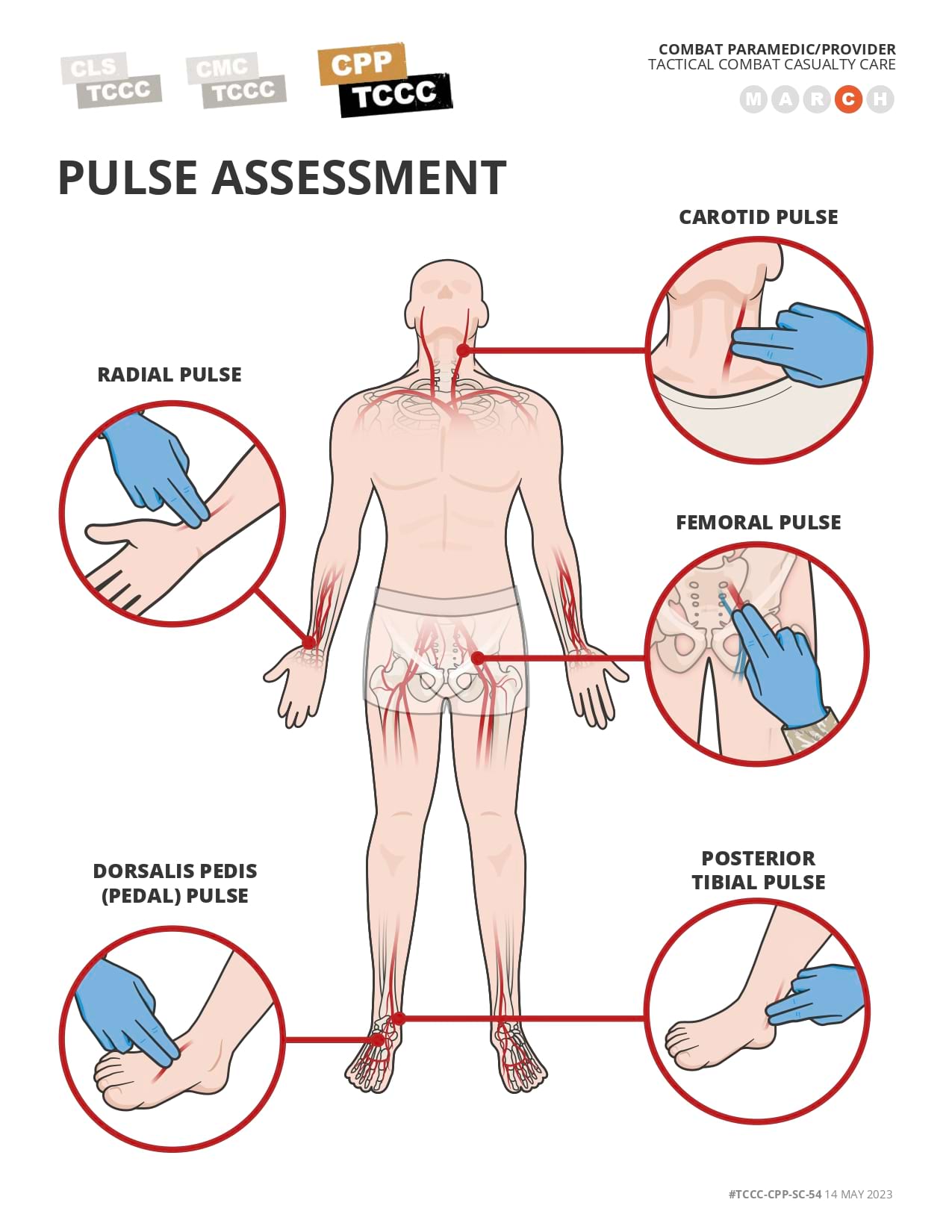 Pulse Assessment, cpp, page 1