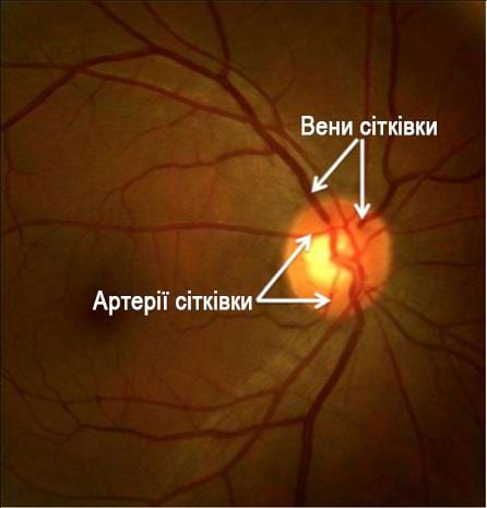 typical-appearance-healthy-retina
